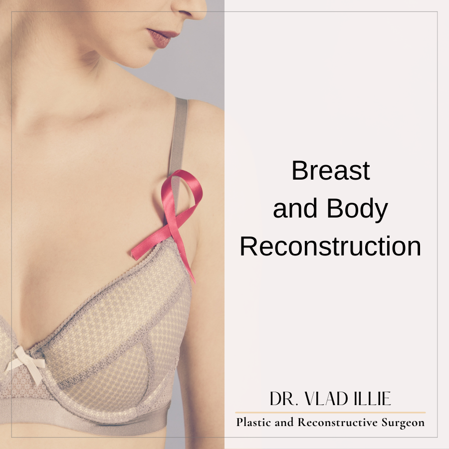 Breast reconstruction in Sydney